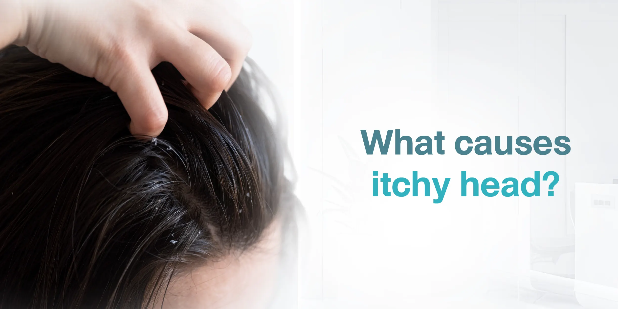 What causes itchy head