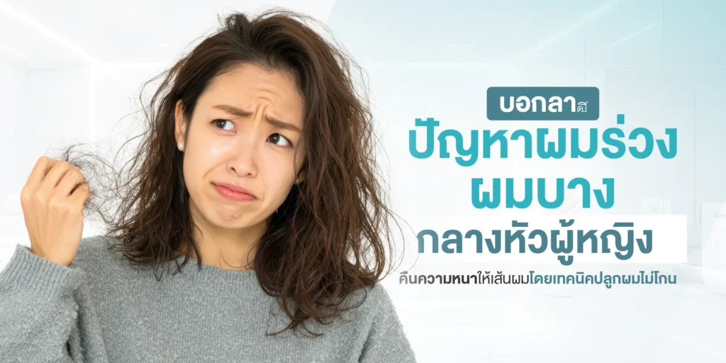 บอกลาปัญหาผมร่วง ผมบางกลางหัว ผู้หญิง คืนความหนาให้เส้นผมโดยเทคนิคปลูกผมไม่โกน