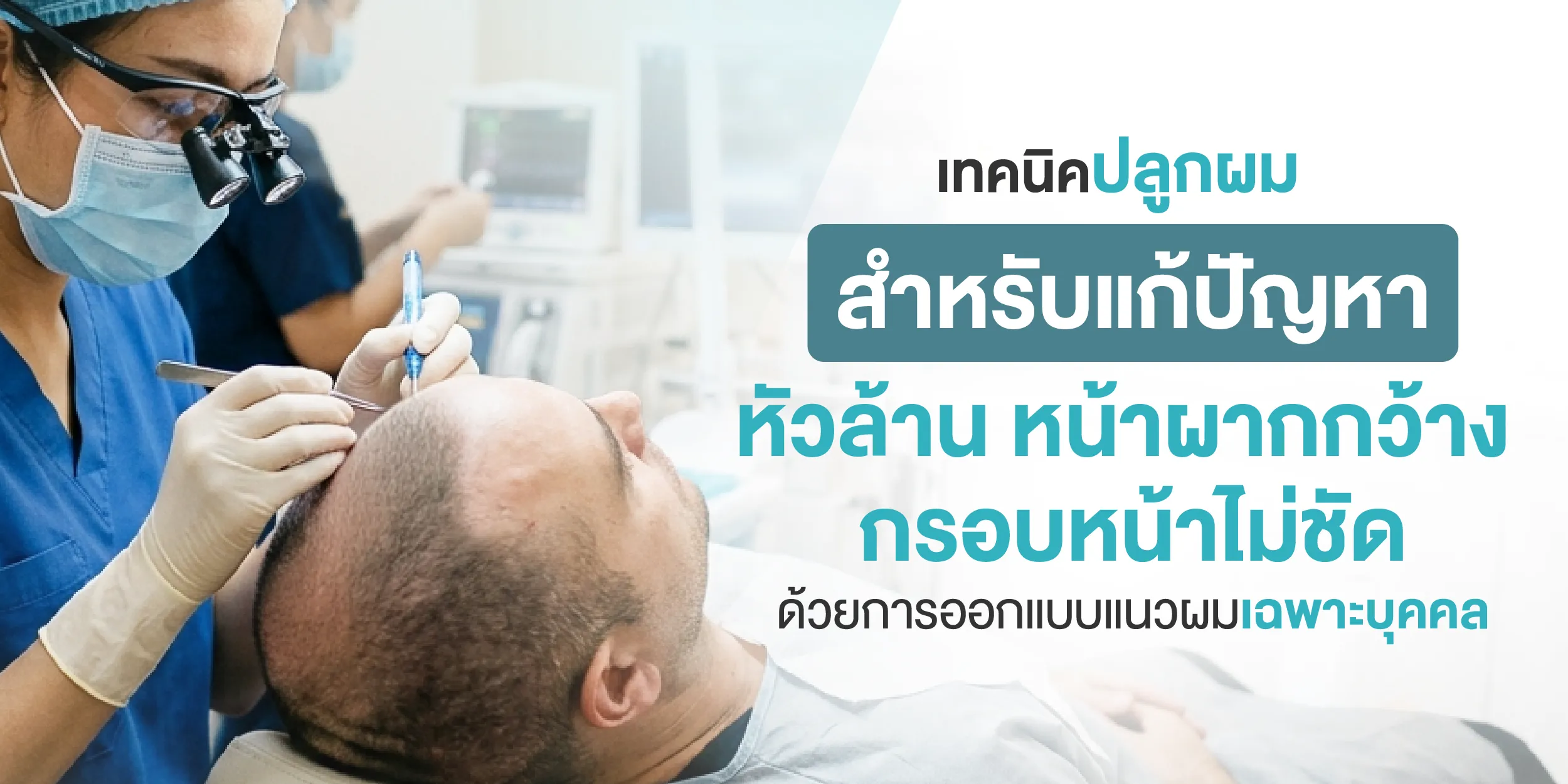 เทคนิคปลูกผม สำหรับแก้ปัญหาหัวล้าน หน้าผากกว้าง กรอบหน้าไม่ชัด
