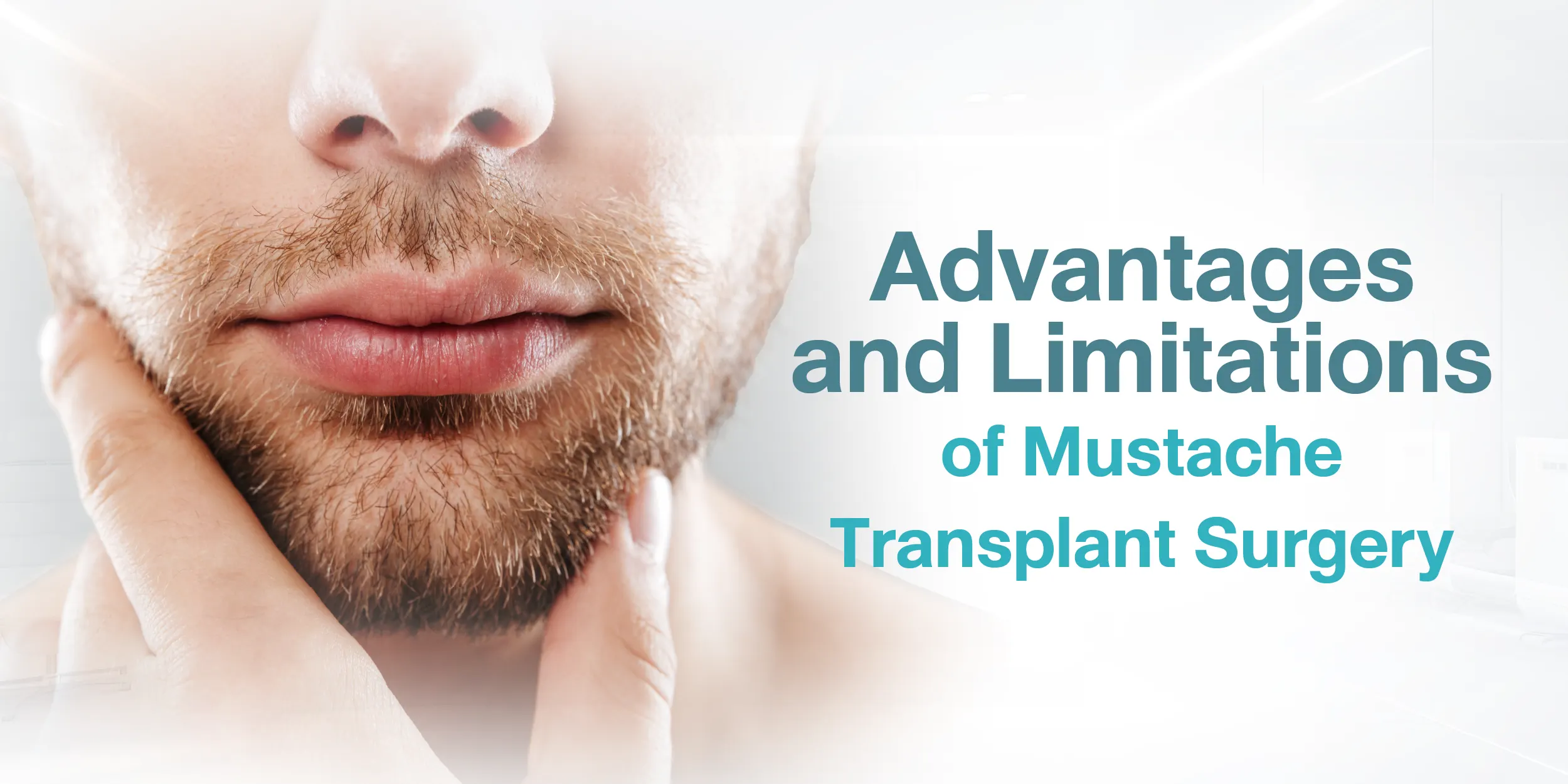 Advantages and Limitations of Mustache Transplant Surgery