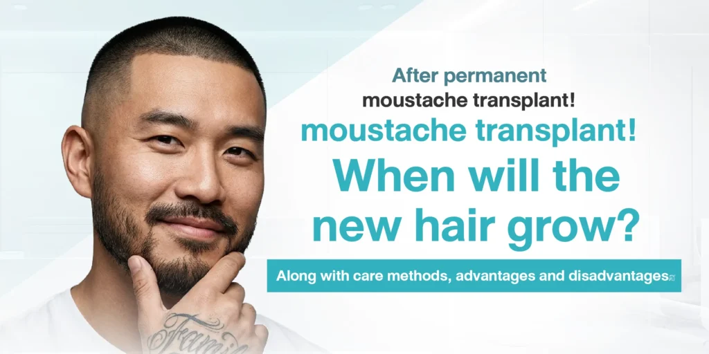 After permanent moustache transplant! When will the new hair grow Along with care methods, advantages and disadvantages