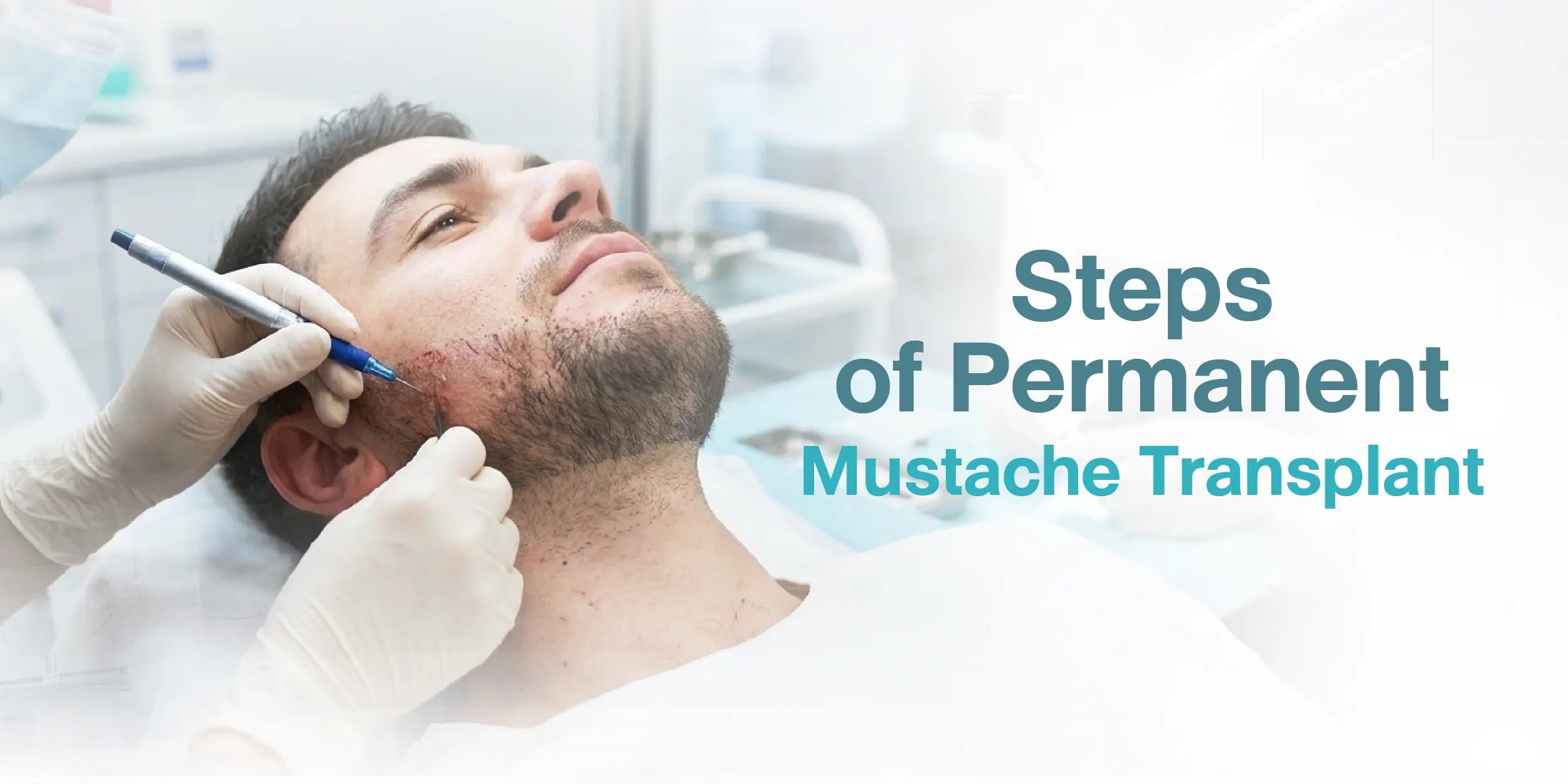 Steps of Permanent Mustache Transplant