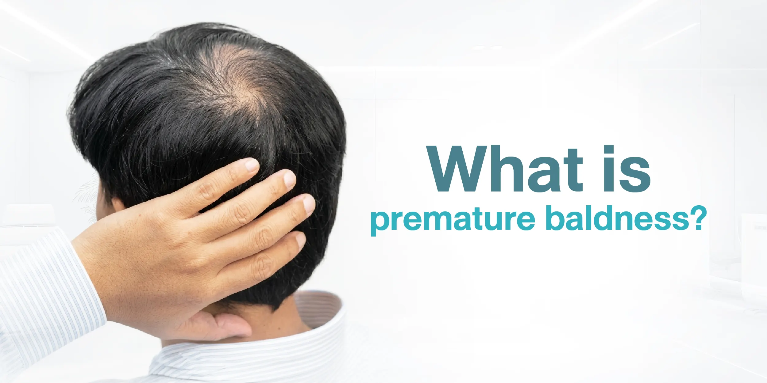 What is premature baldness