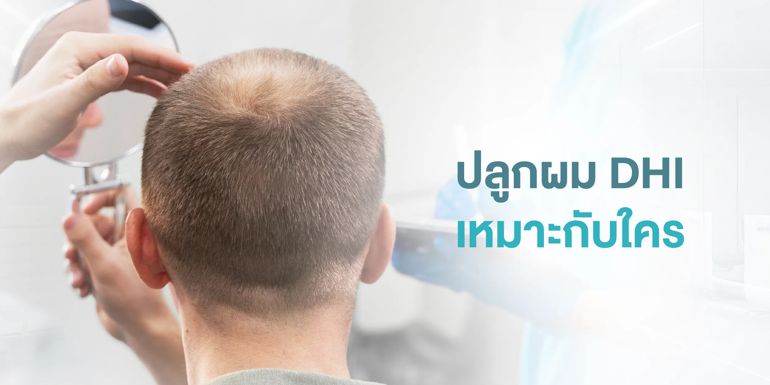 ปลูกผม DHI เหมาะกับใคร