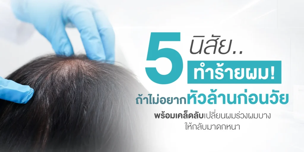 5 นิสัยทำร้ายผม! ถ้าไม่อยากหัวล้านก่อนวัย พร้อมเคล็ดลับเปลี่ยนผมร่วง