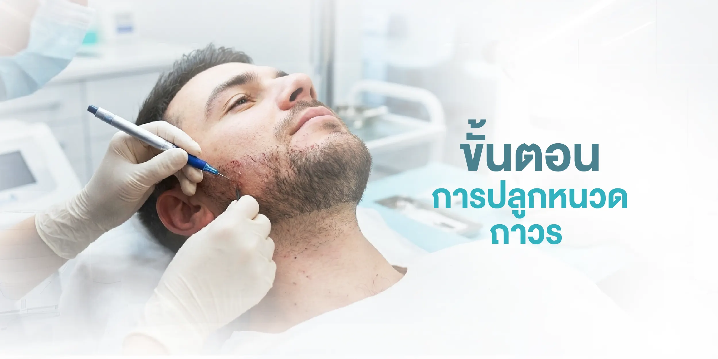 ขั้นตอนการปลูกหนวดถาวร